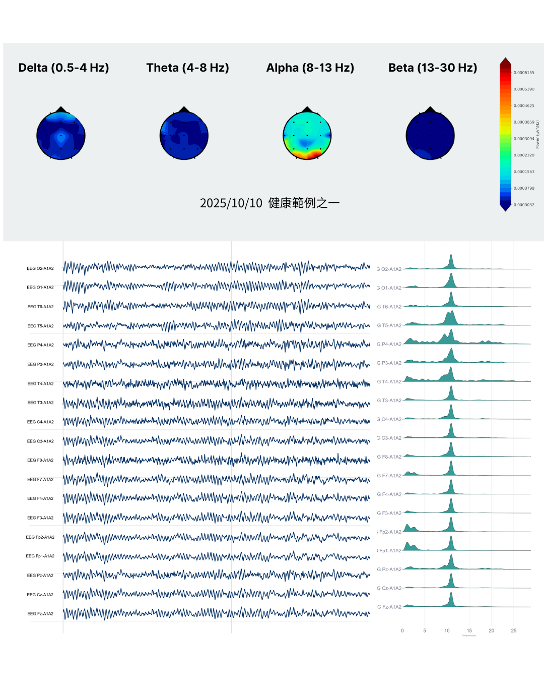 腦波檢測能客觀呈現您當下的大腦狀態，讓您看見自己是處於清醒或昏沉、放鬆或緊繃的狀態。這份數據除了能幫助您更認識自己，也能作為日後身心保健的參考依據。